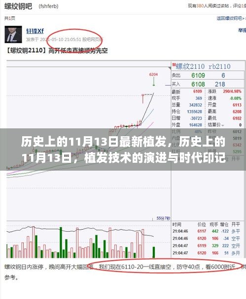 历史上的11月13日，植发技术的演进与时代印记