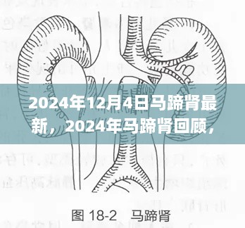 2024年马蹄肾的最新进展与时代印记中的特殊标志回顾