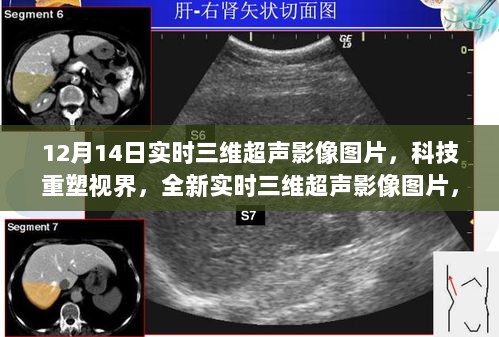 实时三维超声影像揭秘未来医疗的魅力，科技重塑视界的新篇章