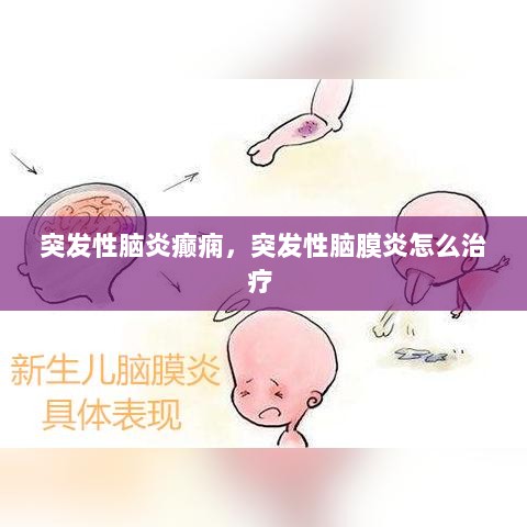 突发性脑炎癫痫，突发性脑膜炎怎么治疗 