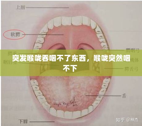 突发喉咙吞咽不了东西，喉咙突然咽不下 