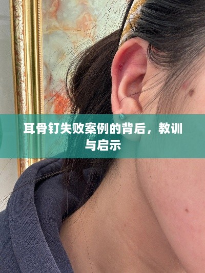 耳骨钉失败案例的背后，教训与启示